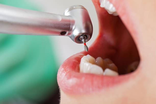 Best Emergency Treatment for Toothache in Ironwood, MI